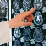Co je Parkinsonova choroba a dá se léčit?